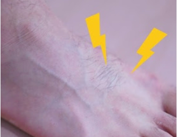 발등이 아픈 이유