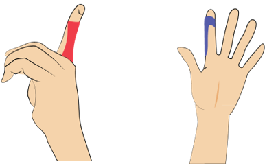 손가락이 삐었을 경우 테이핑요법