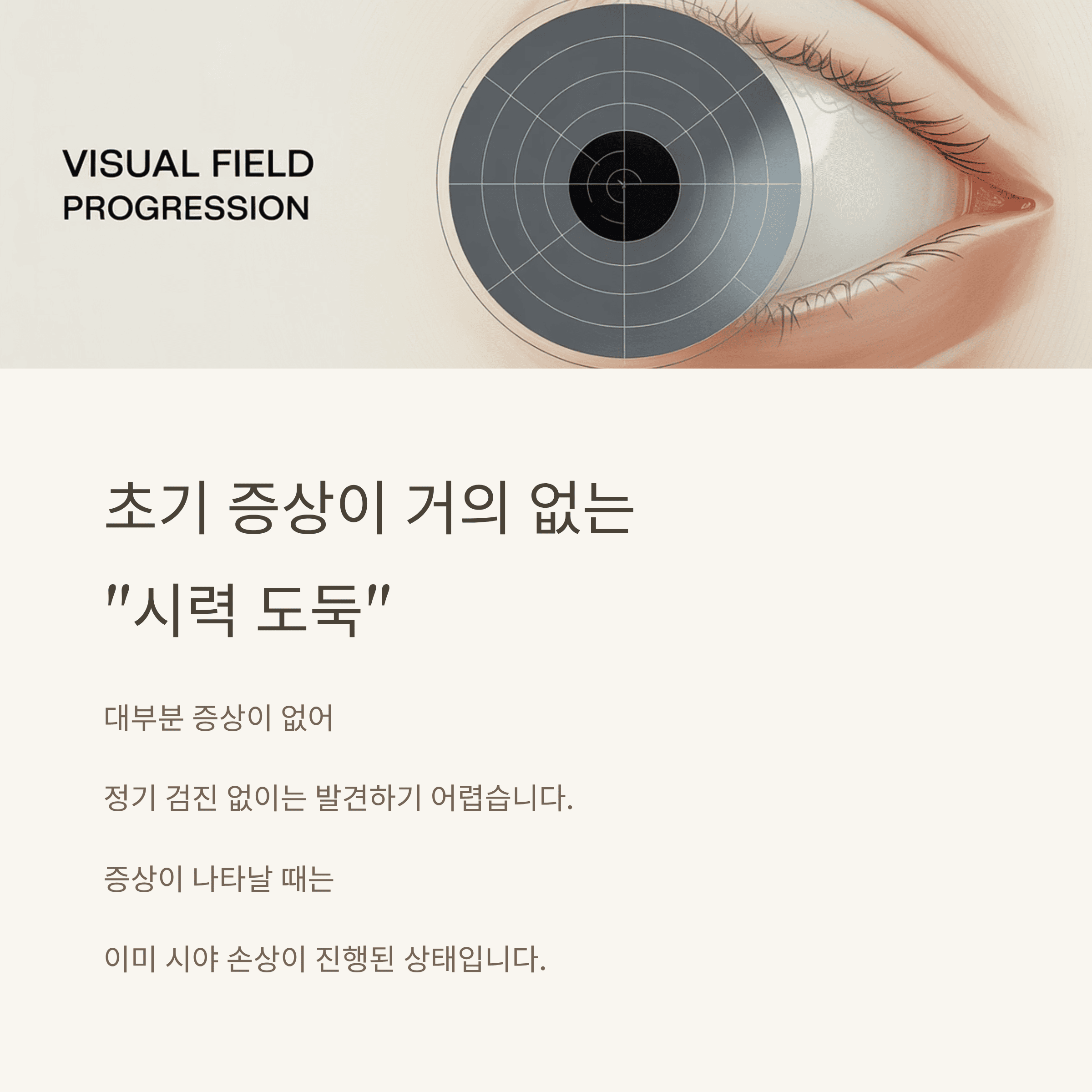 녹내장! 놓치면 늦는 시력 도둑의 진실