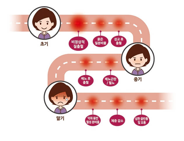 자궁경부암의 증상