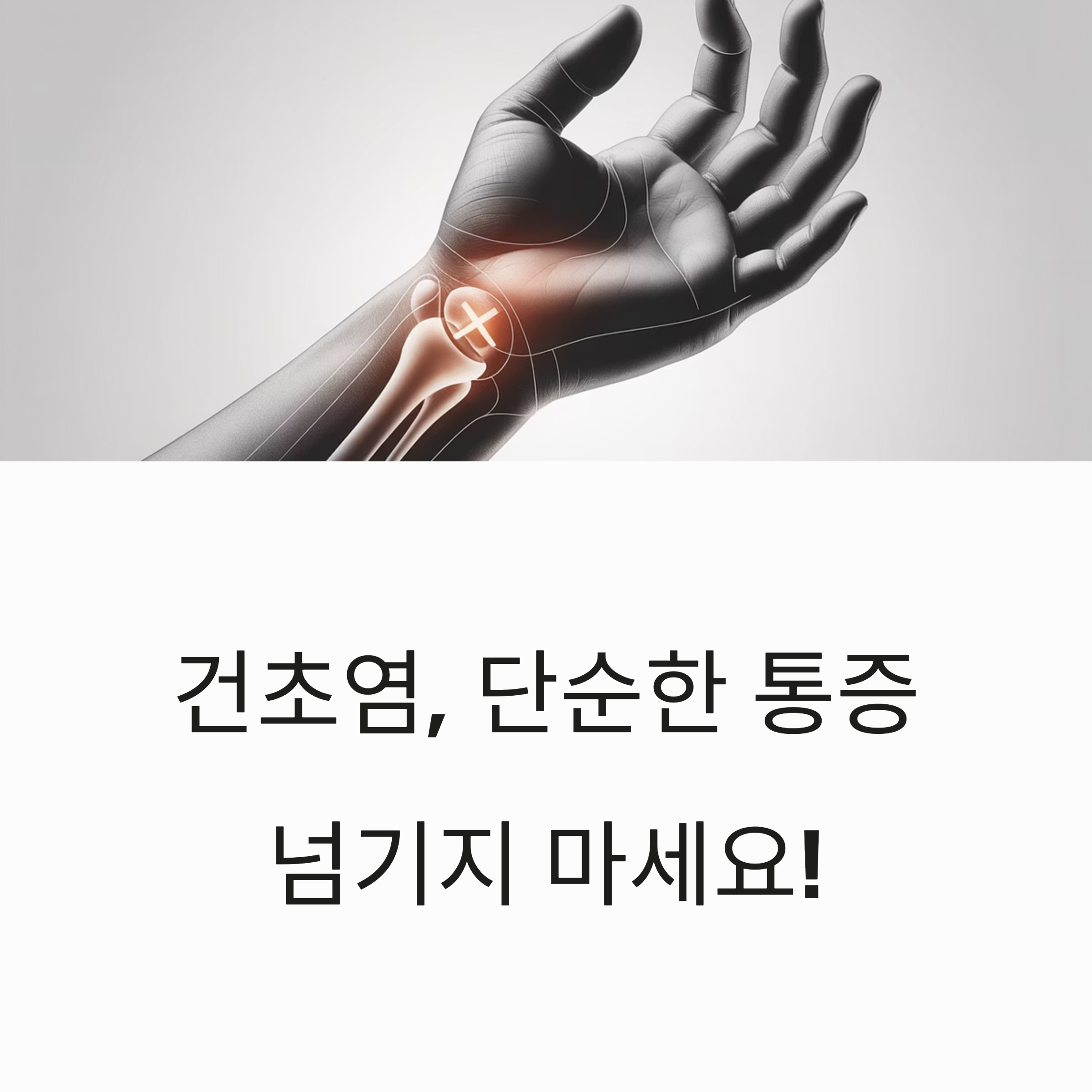 손목 통증 부위에 염증이 강조된 흑백 일러스트와 ‘건초염, 단순한 통증 넘기지 마세요!’라는 경고 문구