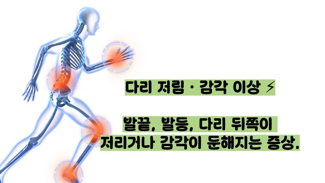 추간판 탈출증 증상
