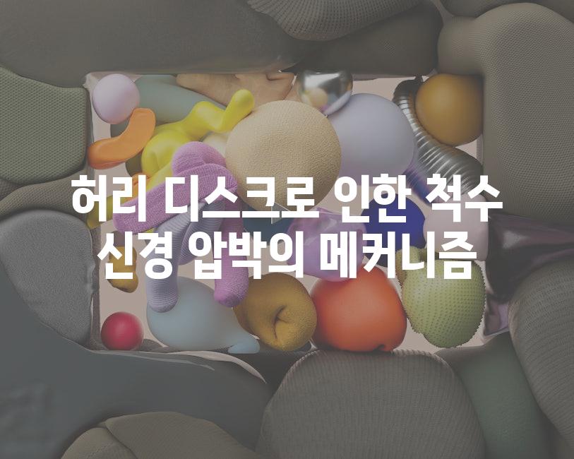 허리 디스크로 인한 척수 신경 압박의 메커니즘
