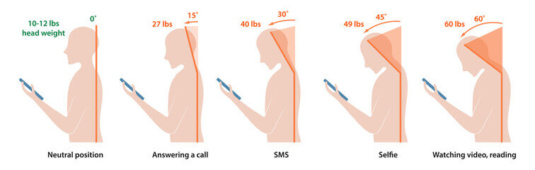 뒷목 땡김 이 있는 두통 여러가지 원인들이 있습니다. 두통이 있을 때 목 뒤가 따끔거리는 느낌이 들고 어깨 승모근이 뭉쳐져있습니다. 근육이완제와 진통제를 자주 복용하고 어깨를 마사지해도 뒷머리가 쪼개지거나 머리 전체가 터질 것 같은 두통이 계속된다면 매우 힘듭니다. 원인이 무엇인지 참고하시기 바랍니다.