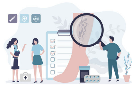 하지정맥류 증상 수술비용 좋은운동 등 총정리(2024 최신)