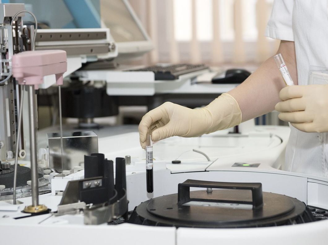 간 수치 정상 범위