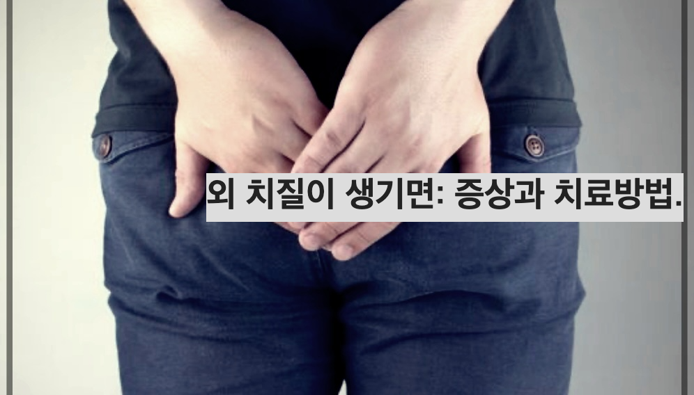 외 치질이 생기면: 증상과 치료방법.