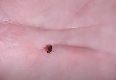 손바닥위 빈대1마리