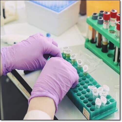 알부민 정상수치