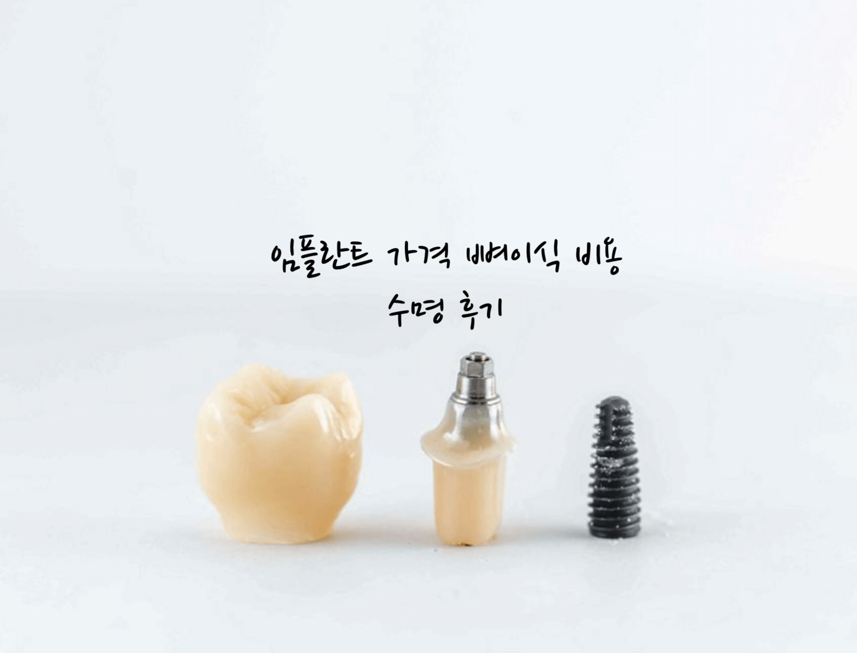 임플란트 가격