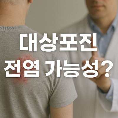 대상포진 전염 가능성 안내 이미지, 감염 증상과 의료진 설명 포함