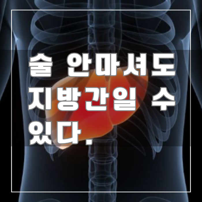 비알콜성 지방간
