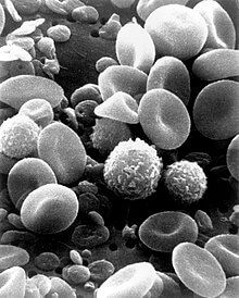 Lymphocyte 수치