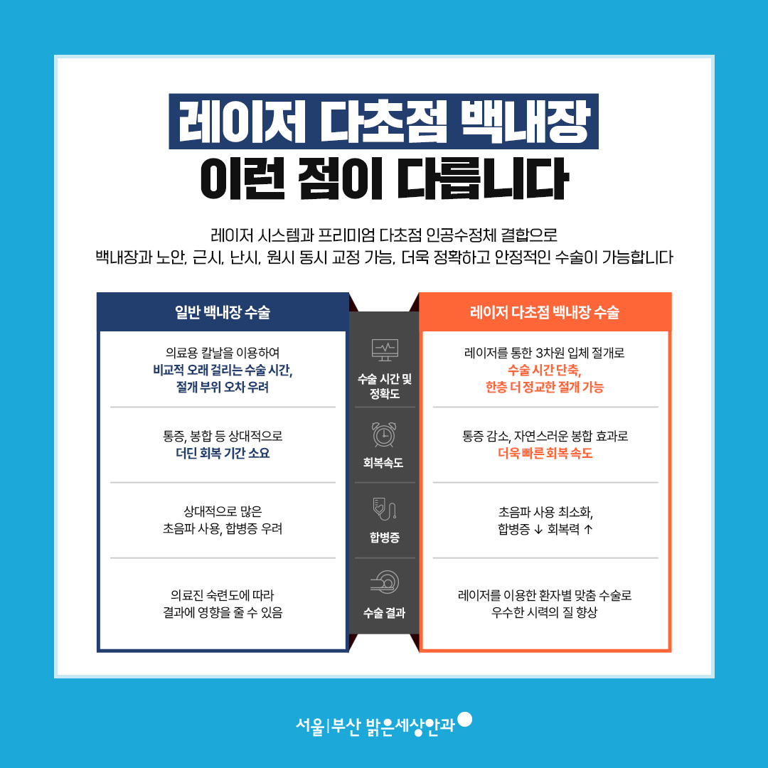 레이저 다초점 백내장