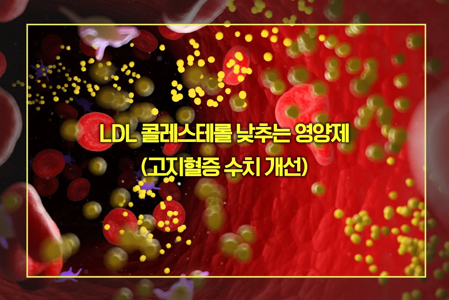 고지혈증 수치 개선