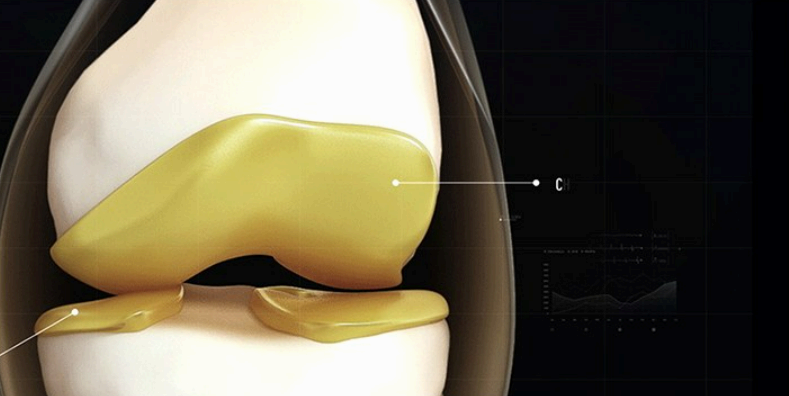 콘드라이친 사진