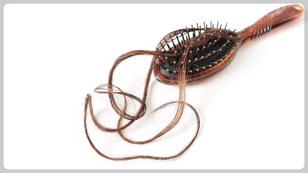 탈모예방 머리카락