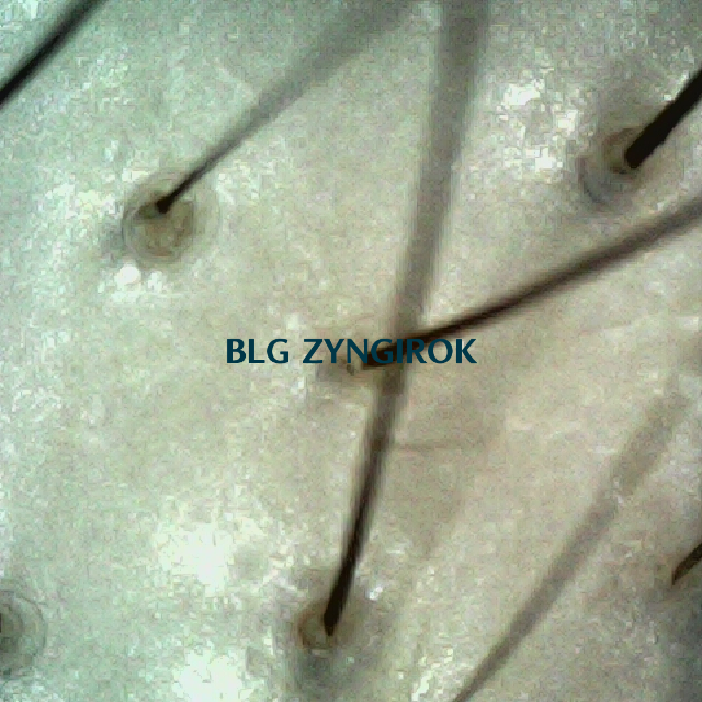 피나모아 복용 12주차 두피 사진 - 정수리와 이마 사이 위치 모습이다.