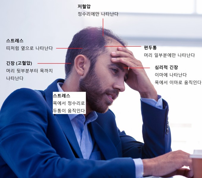 두통의중류