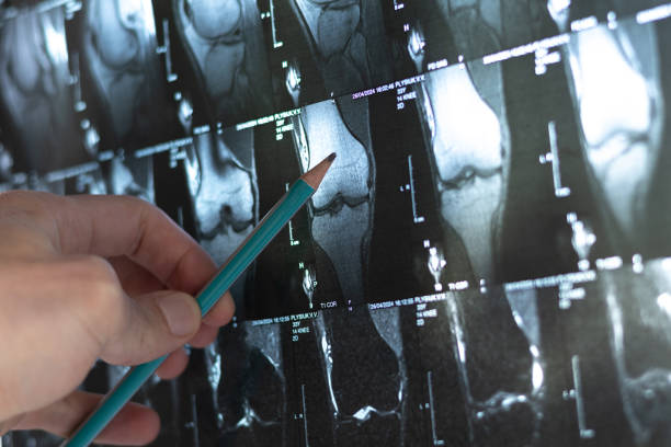 골밀도 검사가 중요한 이유