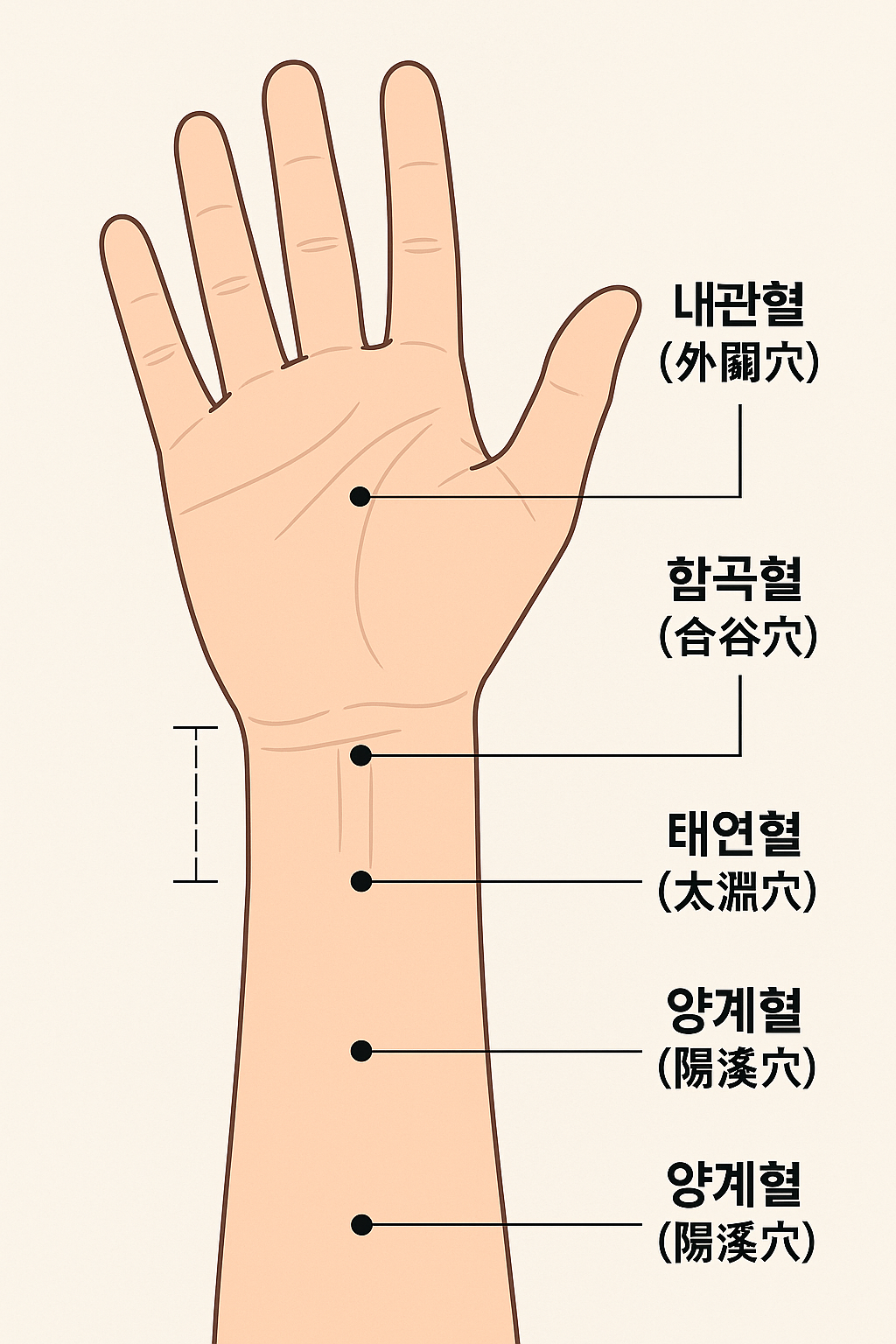 손목 통증 혈자리 소개