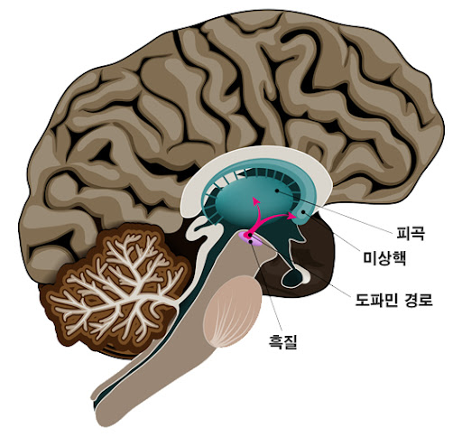 파킨슨병 장애등급