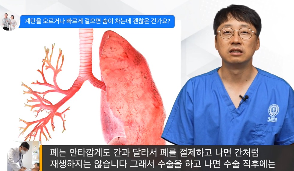 EBS명의-폐암-흉부외과-이창영-교수