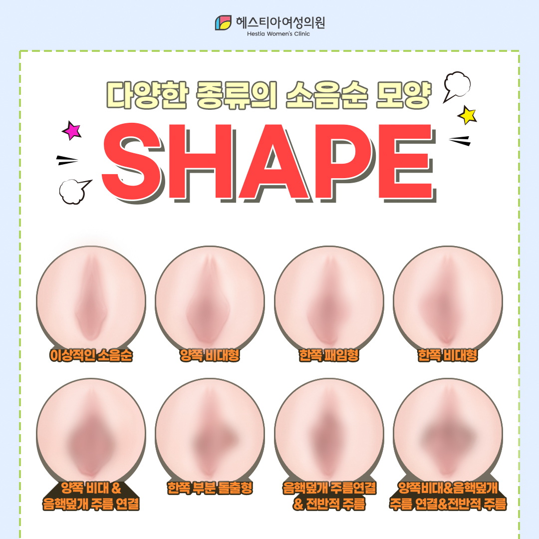 디양한 종류의 소음순모양