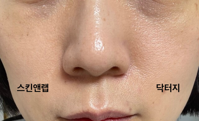 양-볼-선크림-바른후