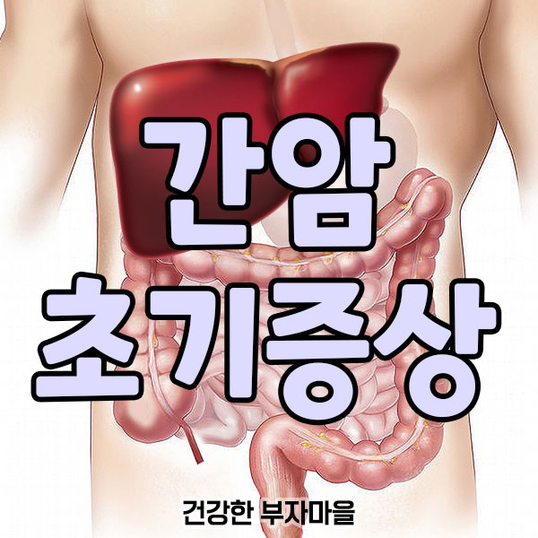간암_초기증상
