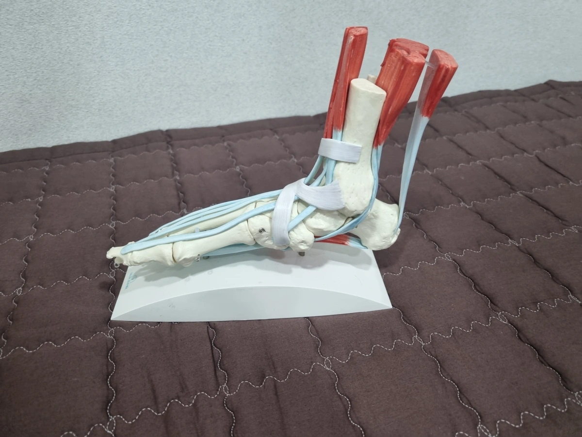 족관절 염좌의 원인, 증상, 진단, 한의원 치료 발목 모형