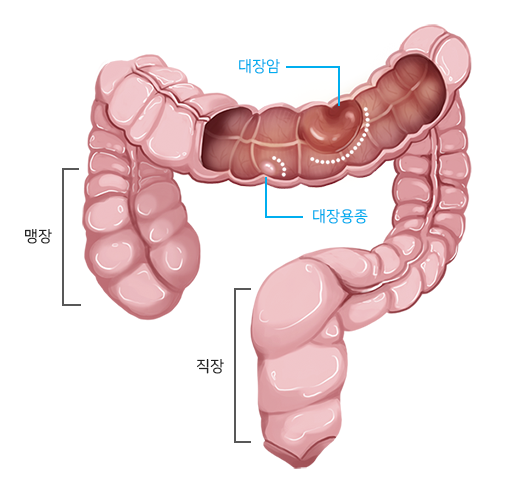 차전자피 효능 먹는법 부작용 (2주 섭취 후기)
