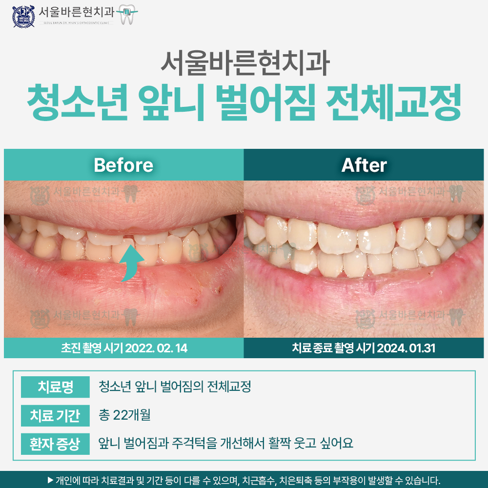 부산교정치과