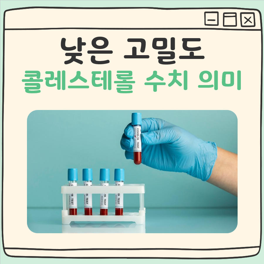 낮은 고밀도 콜레스테롤 의미 대표 이미지