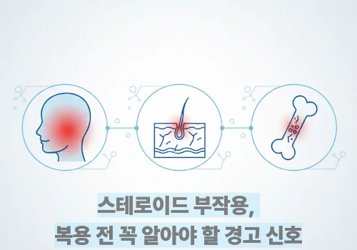 스테로이드 부작용, 복용 전 꼭 알아야 할 경고 신호