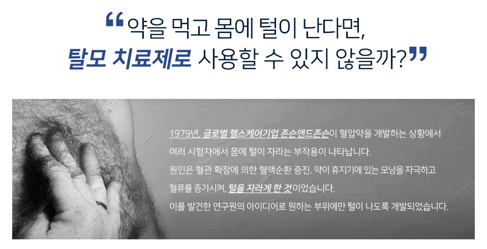 혈압약 만들다 발견한 탈모 치료제