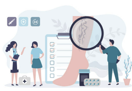 하지정맥류 증상&amp;#44; 수술비용&amp;#44; 도움이 되는 운동