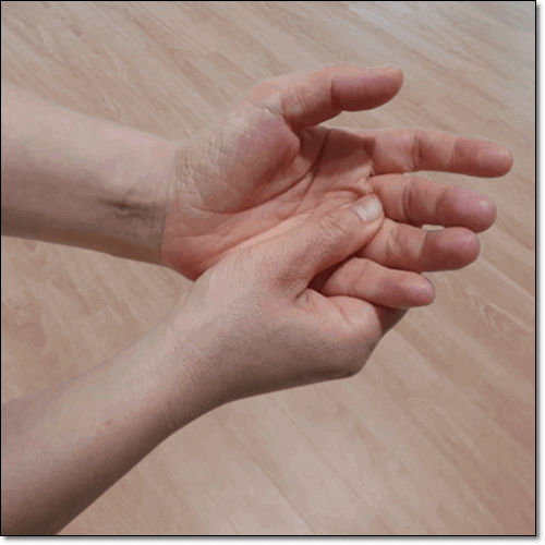 파킨슨병 초기 증상 떨림