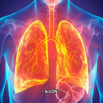 이문수 사망 폐암