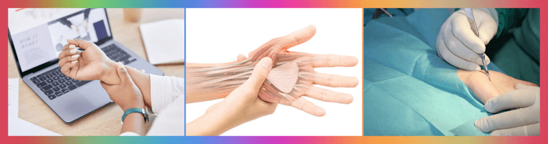 손목 터널 증후군 수술