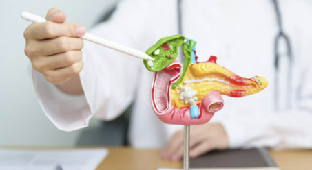 췌장암 초기증상 검사방법 발생원인 총정리(최신)