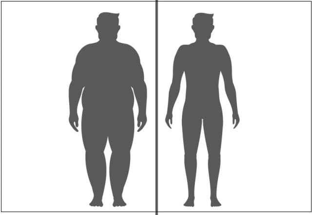 “뚱뚱한 사람일수록 암 수술 후 생존율 높다"...그러나 췌장암 위험 높아