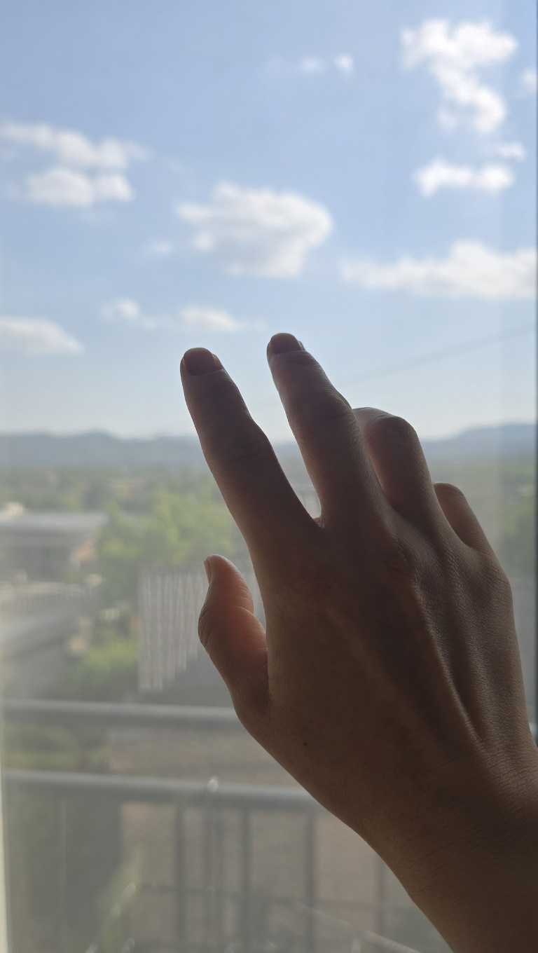 창가에서 손 상태를 확인하는 모습, 컨디션 변화를 느끼는 순간