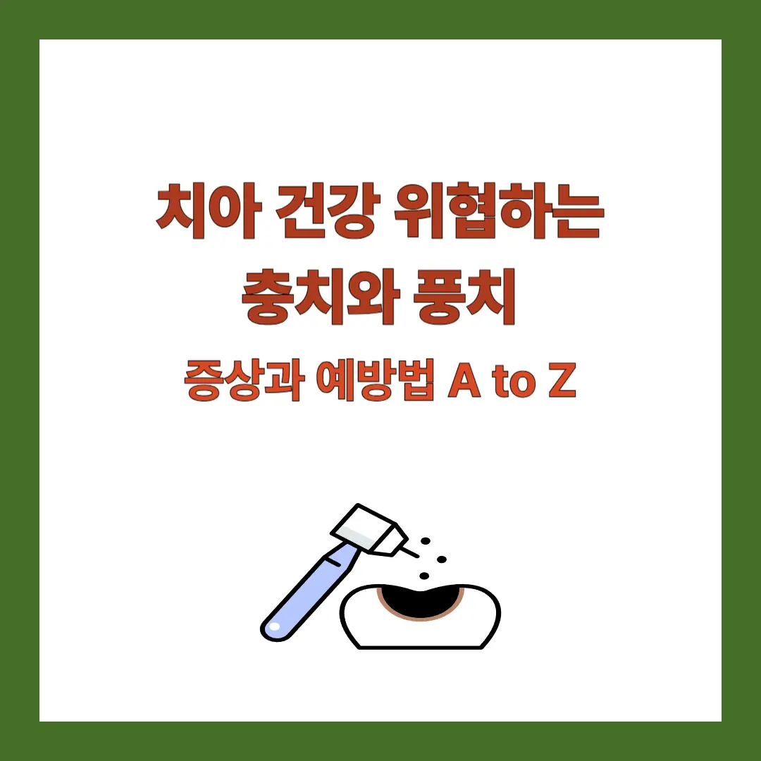 충치-풍치-예방법