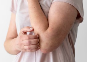 콜린성-두드러기-1