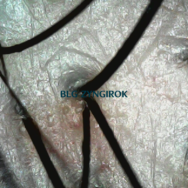 탈모 극복 프로젝트 - 뒷머리 두피 모습이다.