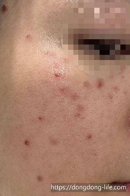 중계의원 기미 리뷰