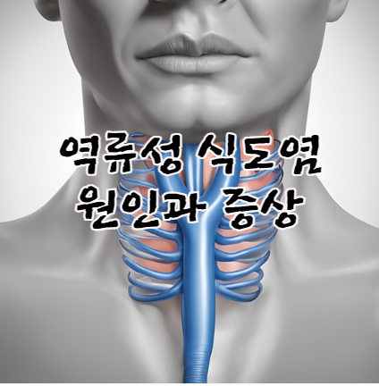 역류성 식도염 원인과 증상