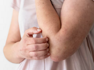 피부묘기증 원인