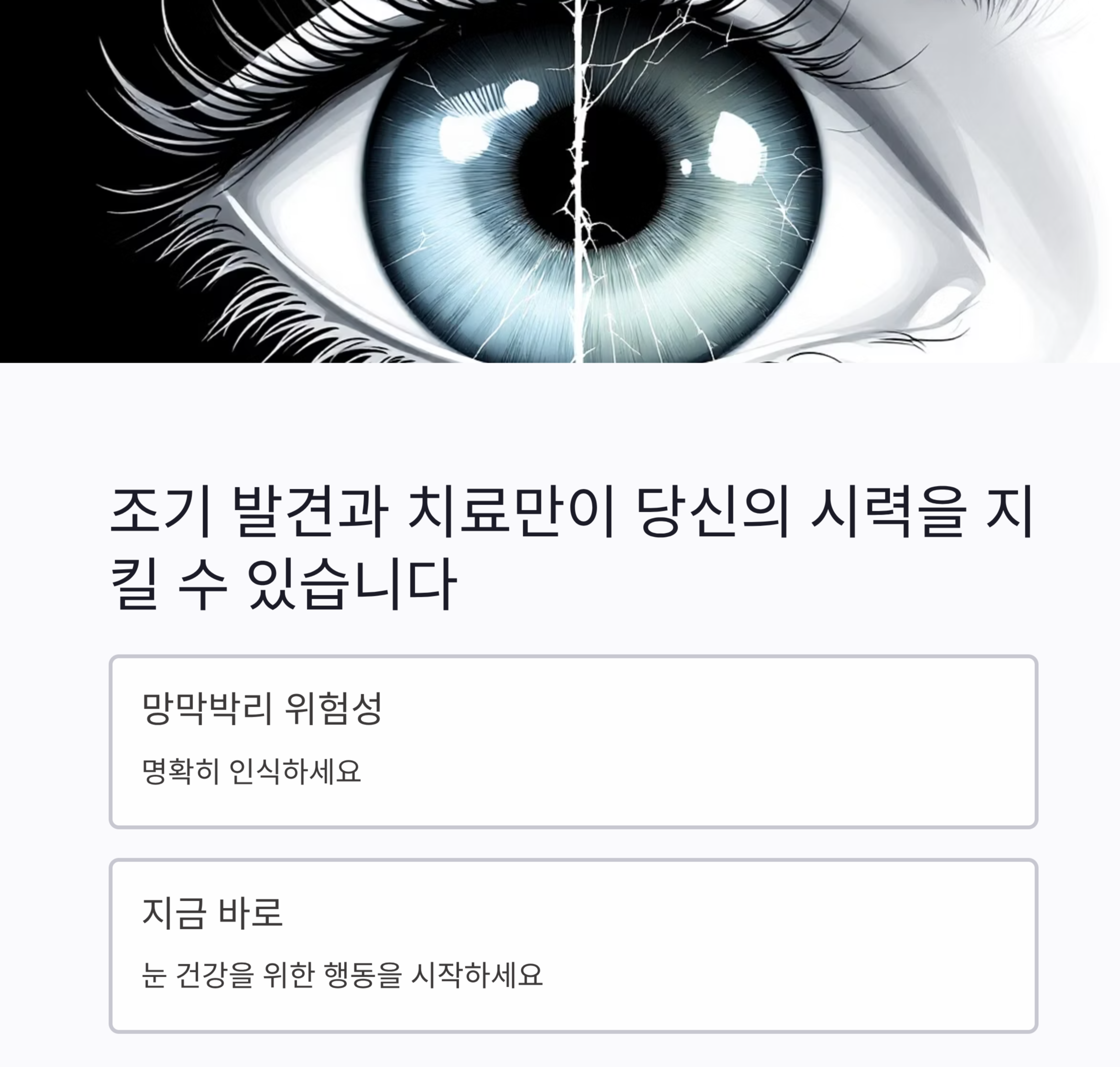 (망막박리)